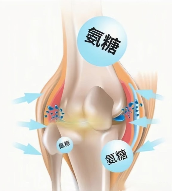 骨病疼痛总反复?抓住“冬病夏治”黄金期,氨糖疗法帮你养出好关节 骨病疼痛总反复?抓住“冬病夏治”黄金期,氨糖疗法帮你养出好关节