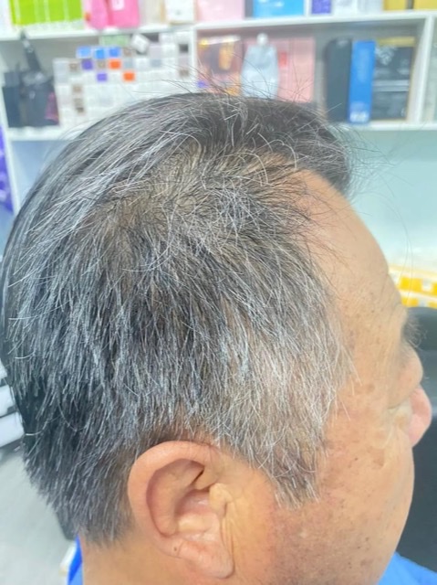 别以为老了才白发多,原来是营养在“捣乱” 别以为老了才白发多,原来是营养在“捣乱”