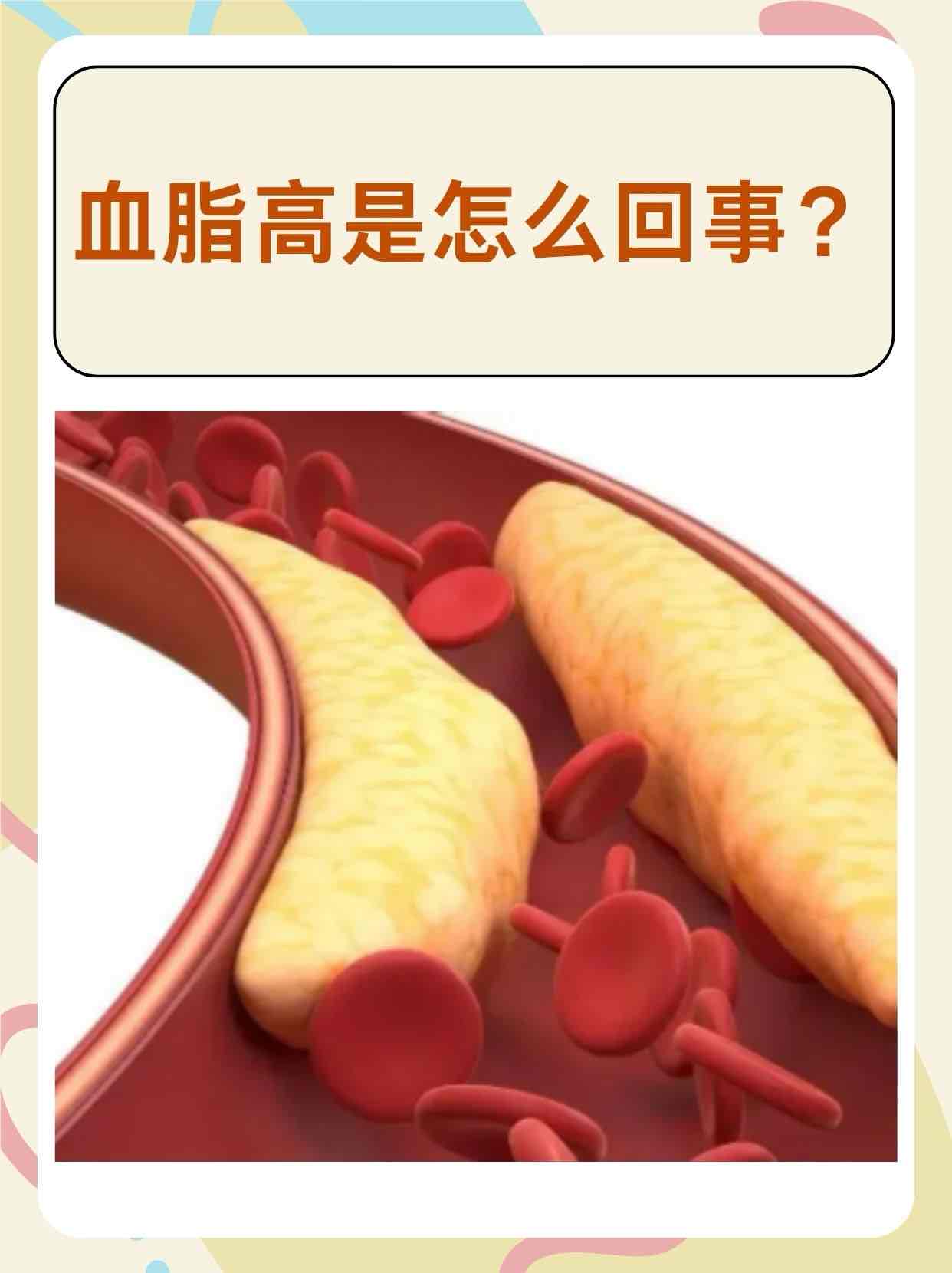 老人注意!血管里若“积了油”,身体会发信号,别等堵了才着急 老人注意!血管里若“积了油”,身体会发信号,别等堵了才着急