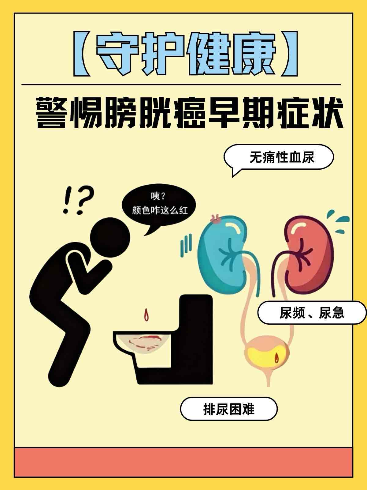中老年人无痛血尿:别忽视膀胱癌的“沉默求救信号” 中老年人无痛血尿:别忽视膀胱癌的“沉默求救信号”