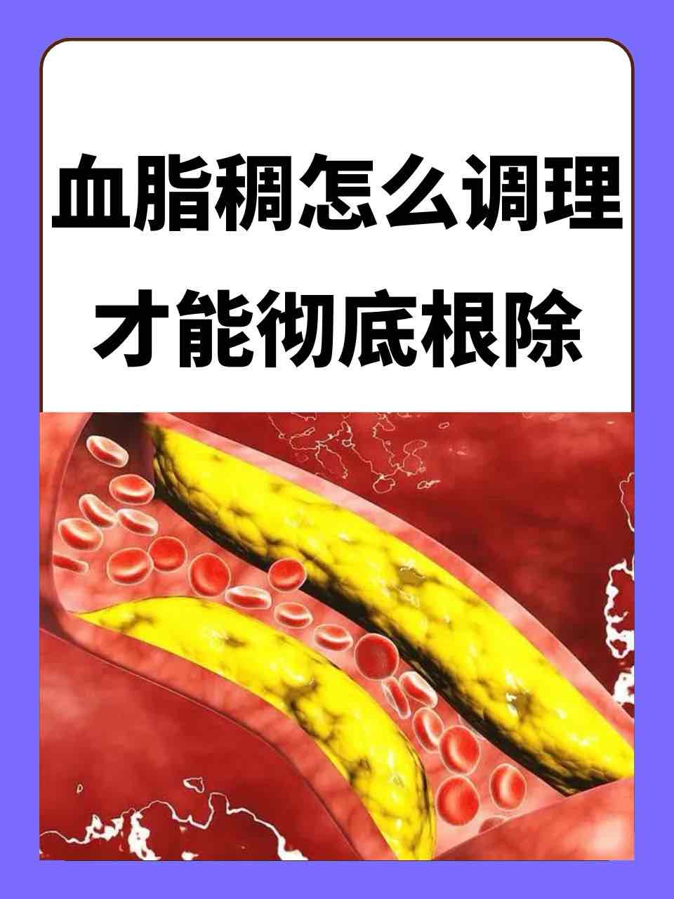 老年人体检血脂七项:揪出最危险的“血管杀手” 老年人体检血脂七项:揪出最危险的“血管杀手”