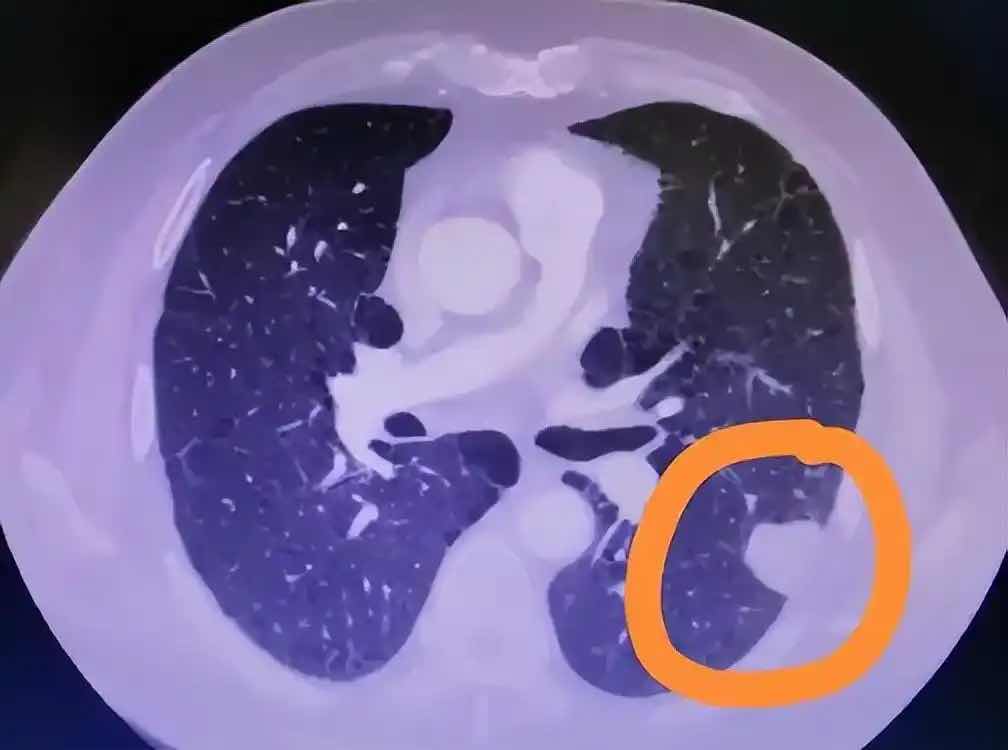 ҽ������棺��Щ��ʳ��ǽ�ڵġ��߻�����