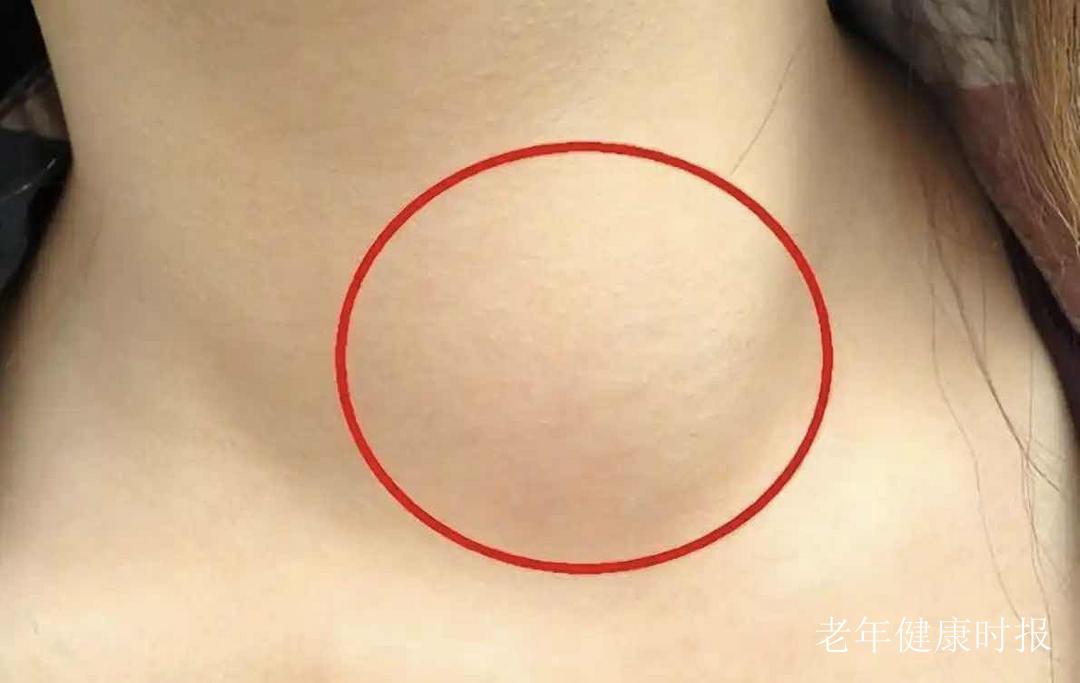 ҽ������棺��Щ��ʳ��ǽ�ڵġ��߻�����