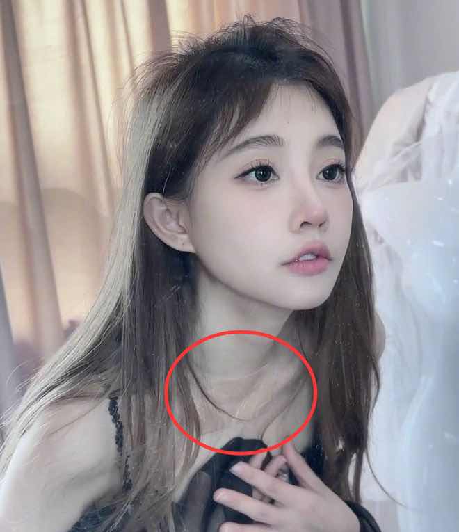 ���ַ���Ī��״�ٰ�������ҽ��������5���쳣�������ܵ�Сë��