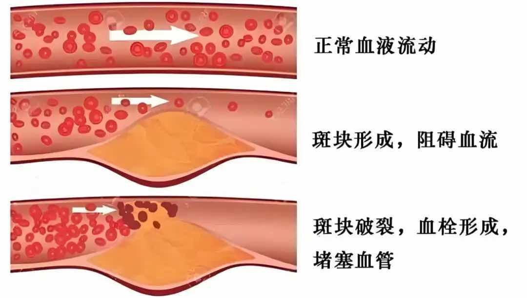 Ѫ����ġ����ε��ˡ����߿鲻�۲�����Σ��ȴ��С