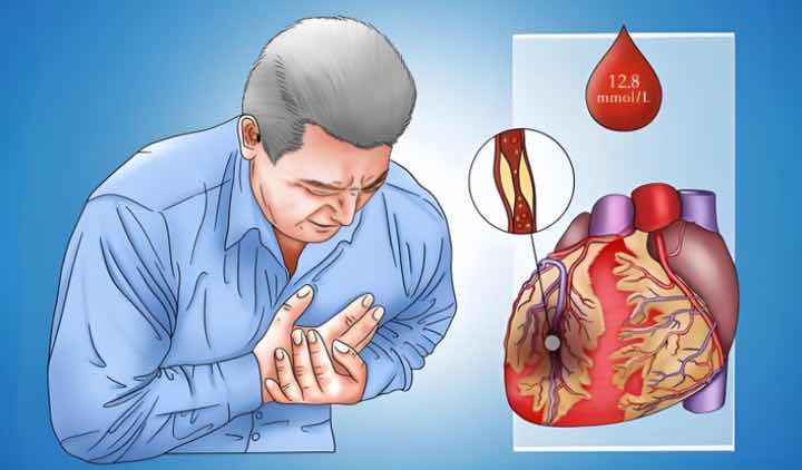 ���ķ籩��Ϊ�����򲡻��߶����������ϣ�