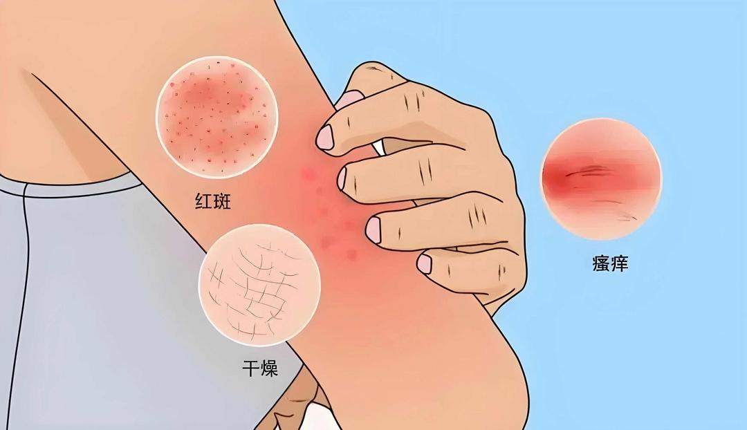 ����Ƥ��������Ӧ�Ը������������ӷ�ɹ