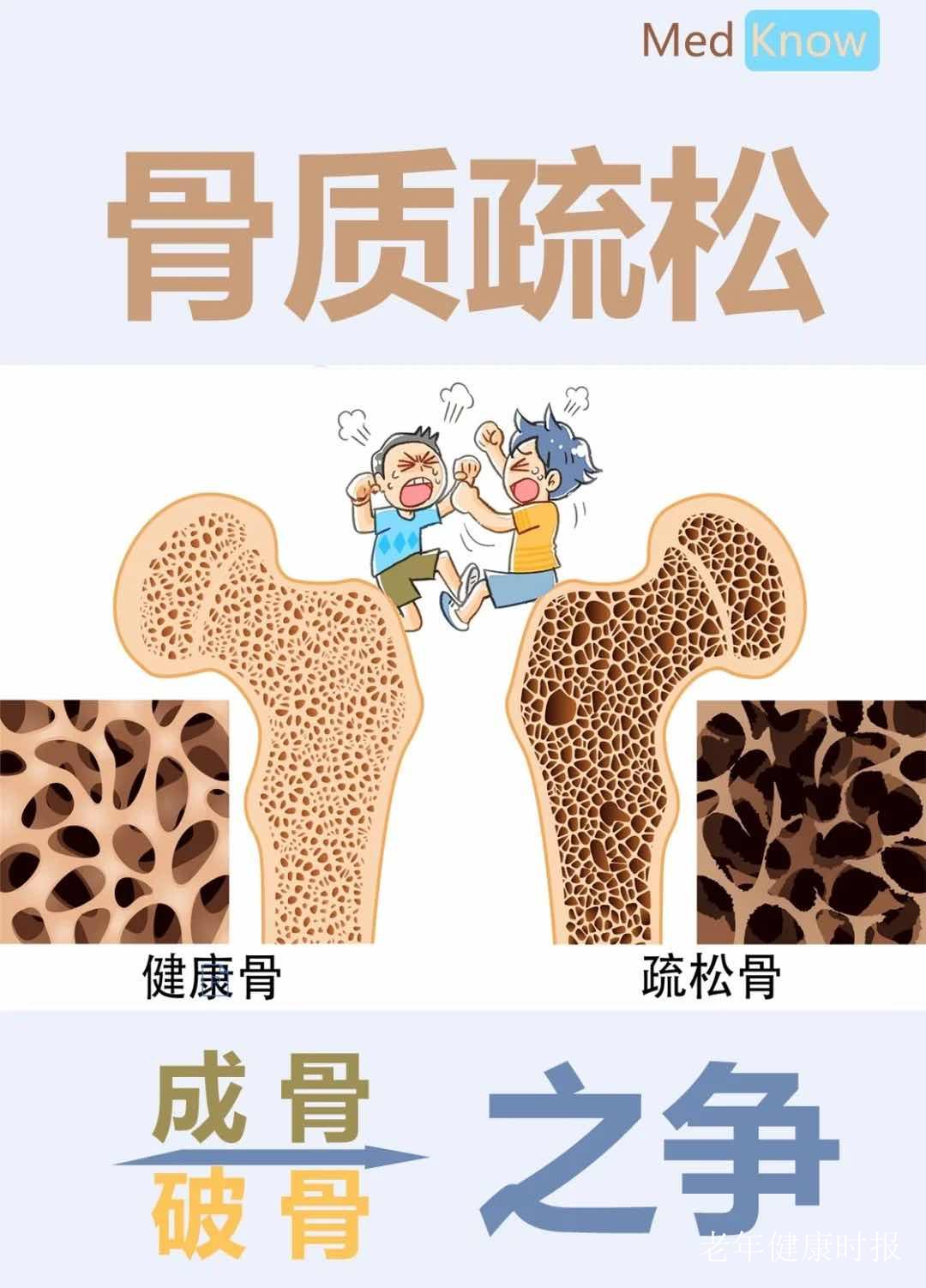 ��ͷ�����ô�죿���ơ����ǡ���������һ����������